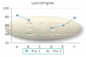 order lamotrigine 50mg on line