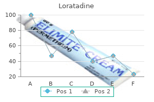 buy 10 mg loratadine otc